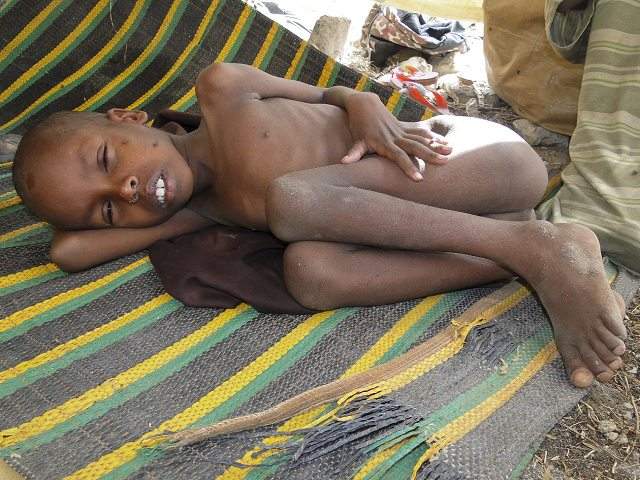 somalia-nino-descansa-en-mogadiscio-tras-huir-de-la-hambruna-del-sur-foto-efe.jpg